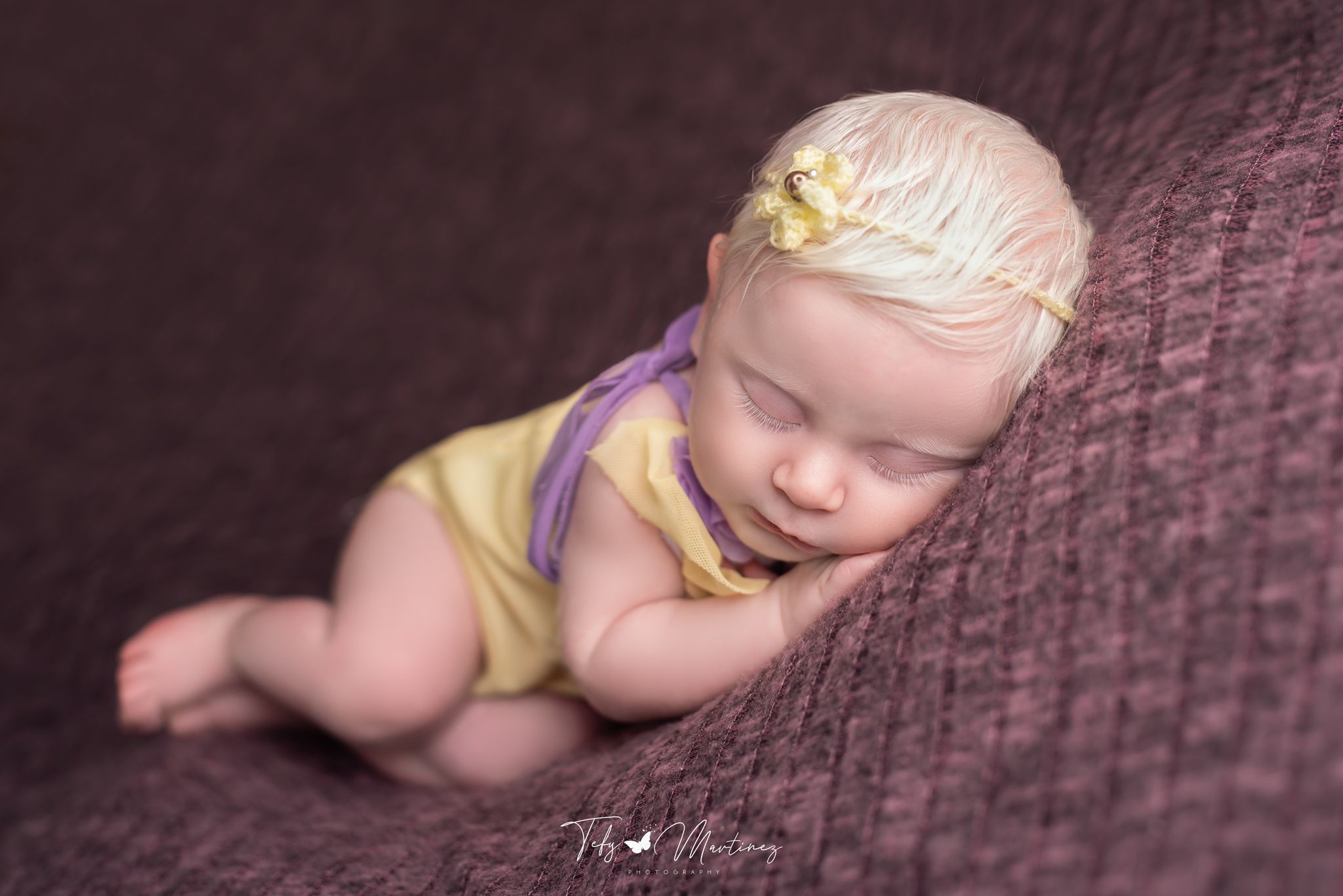 hermosa bebita con albinismo modelo: Alaia